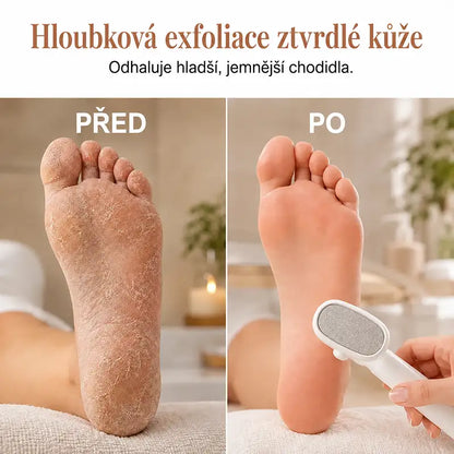 |⚡2026 Obrovská Zľava 70% OFF🔥| ✨Obojstranná škrabka na chodidlá na odstraňovanie stvrdnutej kože - Odstraňovač mozoľov jedným ťahom💫